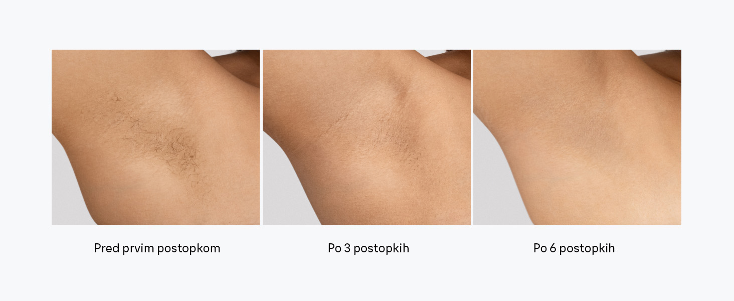 Braun_SilkExpert_Pro5_Premium_aPlusContent_Desktop_1464x600_M4.4